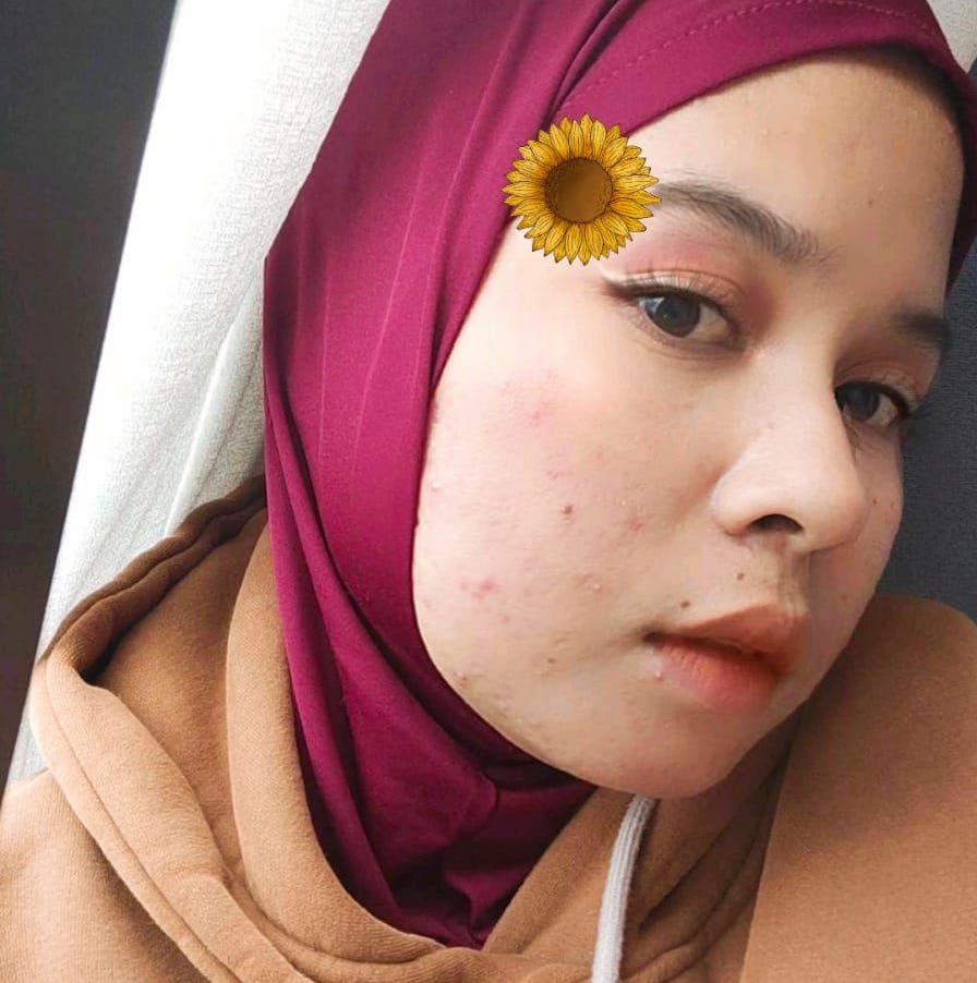Ade Putri